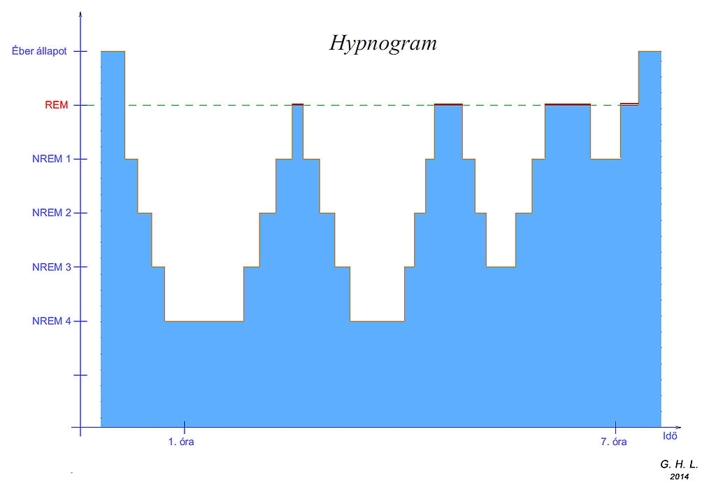 6. Hypnogram